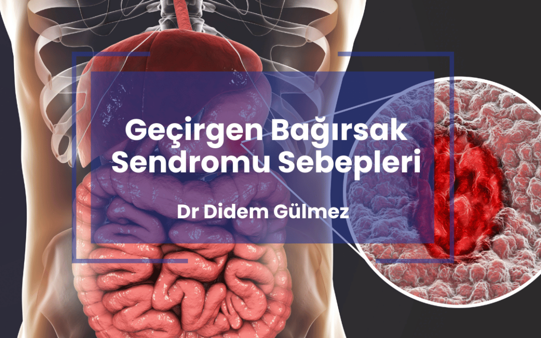 Geçirgen Bağırsak Sendromu Sebepleri