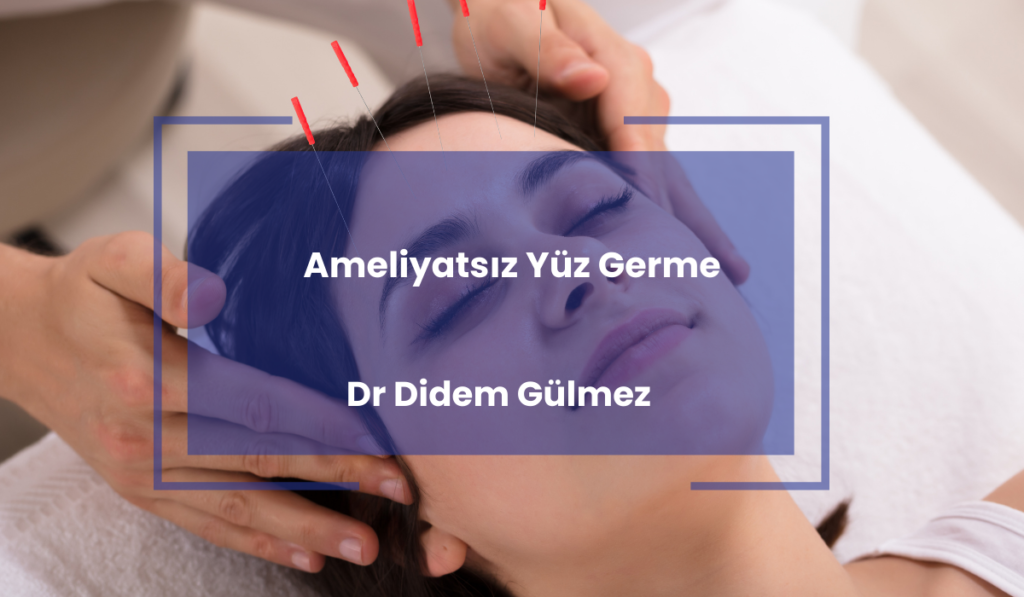 Ameliyatsiz Yuz Germe