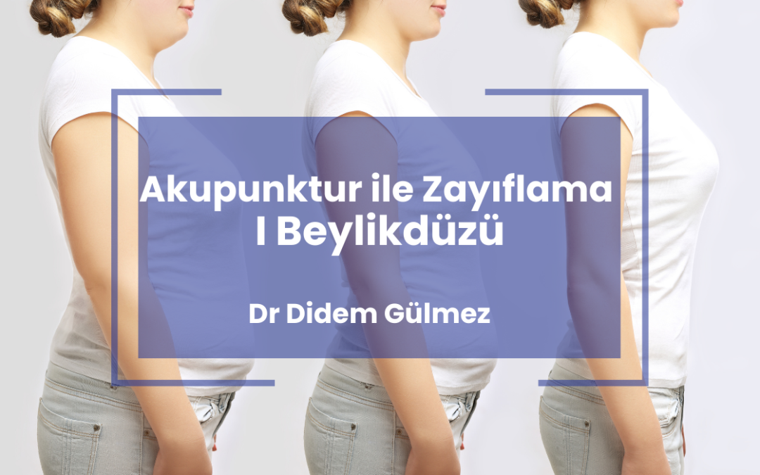 Akupunktur ile Zayıflama I Beylikdüzü