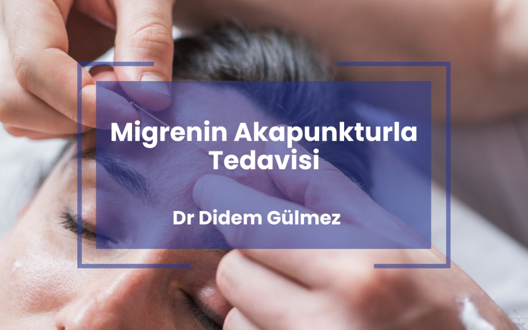Migrenin Akapunkturla Tedavisi