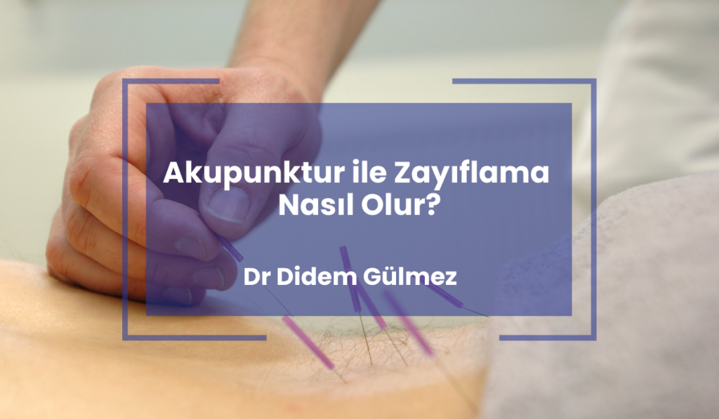 Akupunktur ile Zayiflama