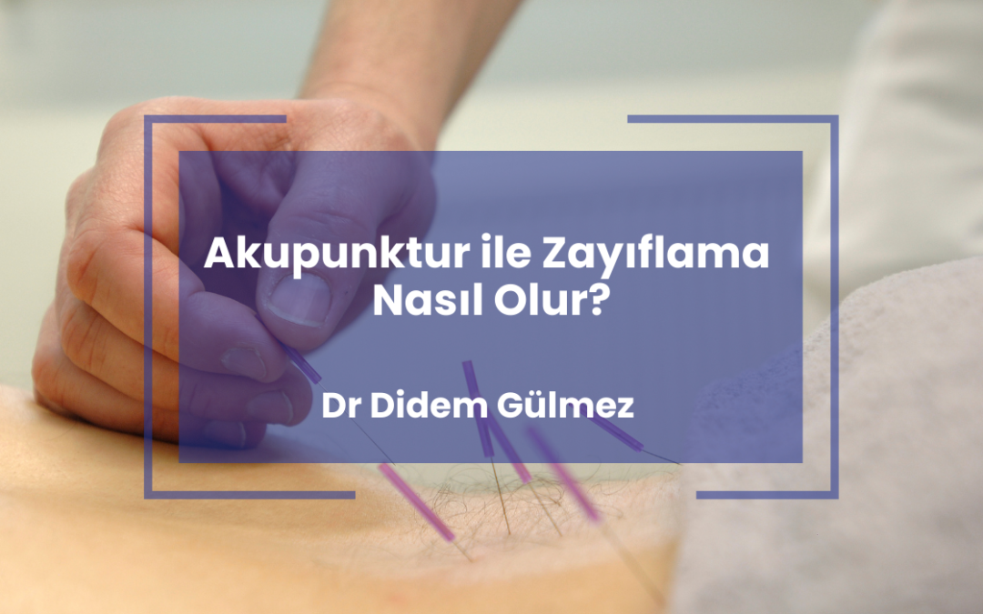 Akupunktur ile Zayıflama Nasıl Olur?
