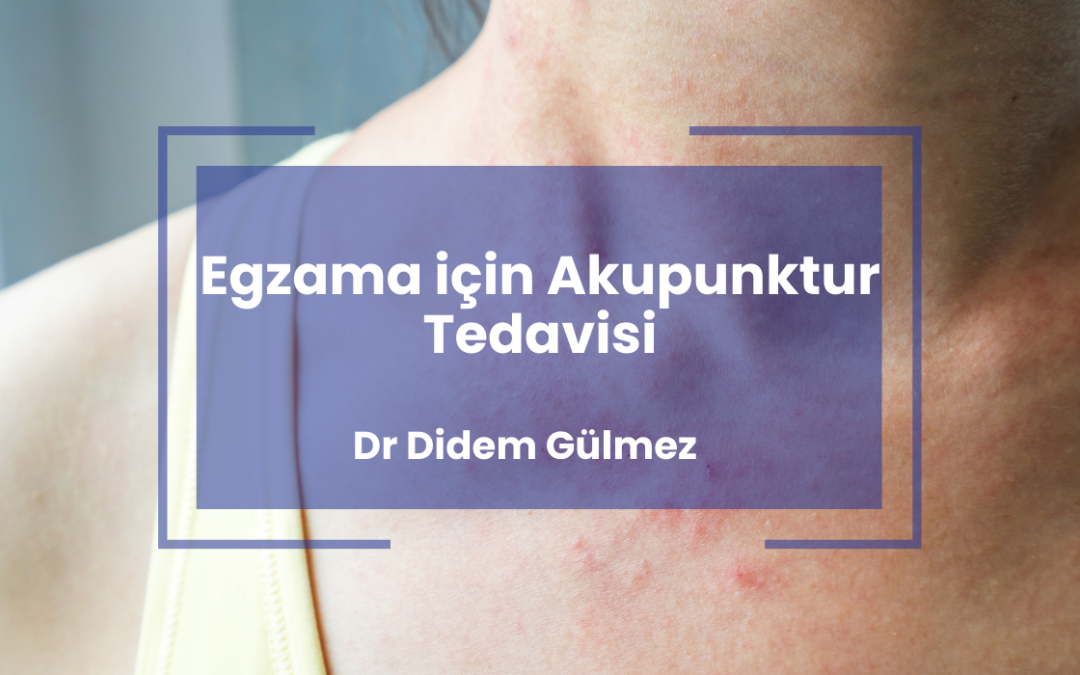Egzama için Akupunktur Tedavisi