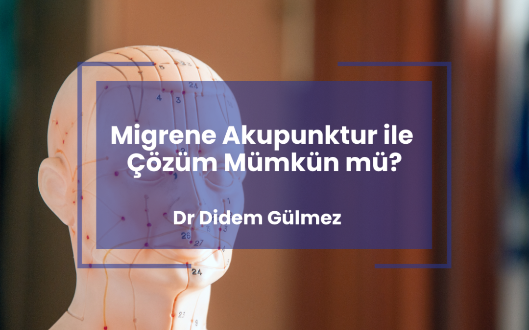Migrene Akupunktur ile Çözüm Mümkün mü?