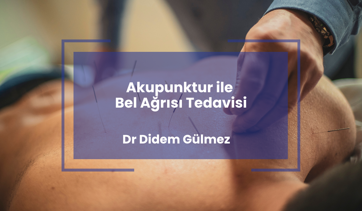 Akupunktur ile Bel Agrisi Tedavisi 
