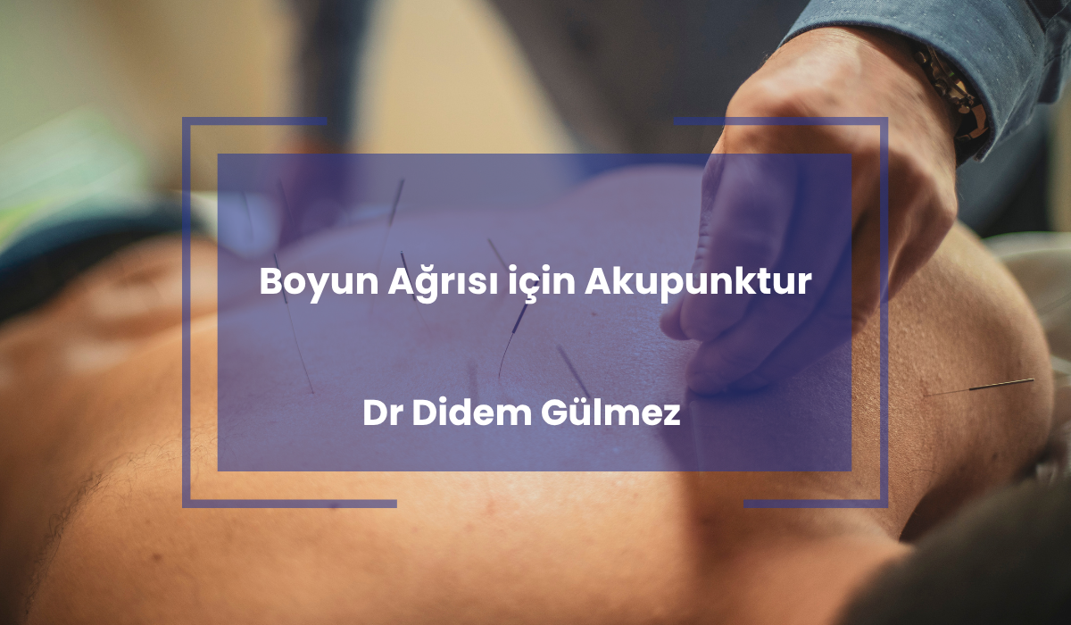 Boyun Agrisi icin Akupunktur