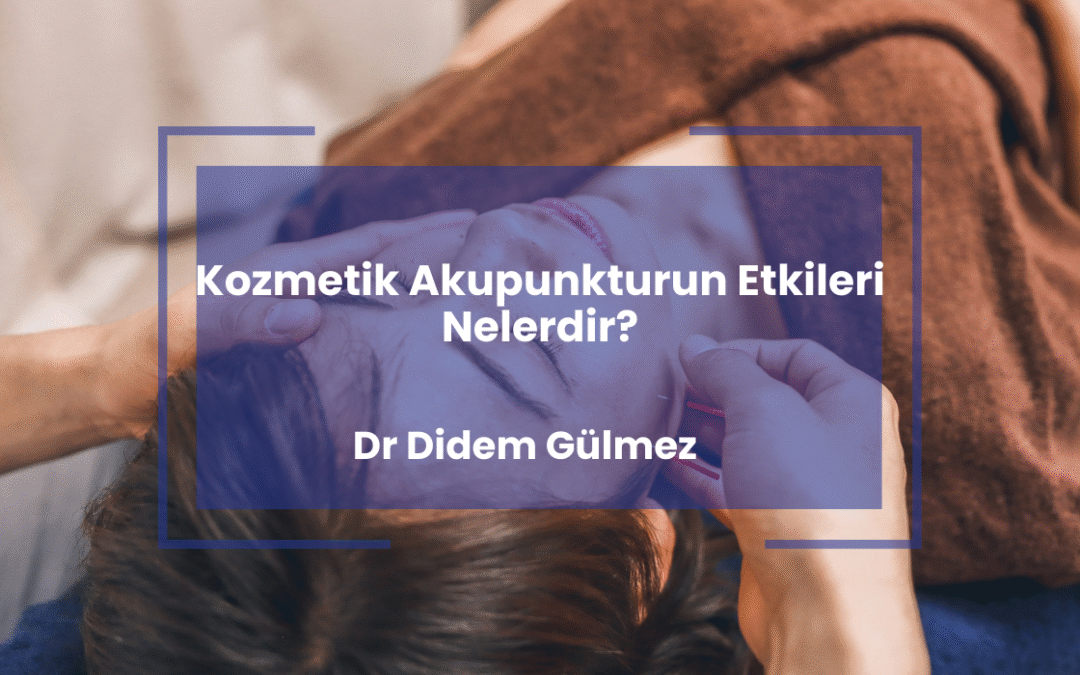Kozmetik Akupunkturun Etkileri Nelerdir?