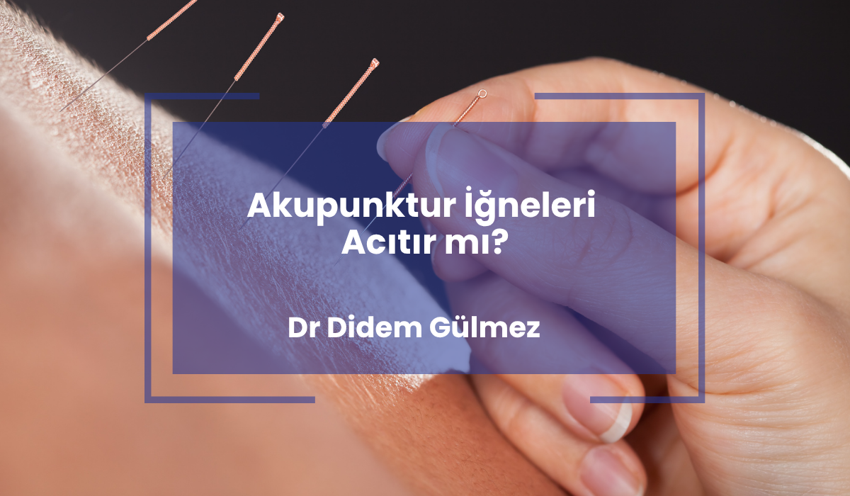 Akupunktur İğneleri Acıtır mı?