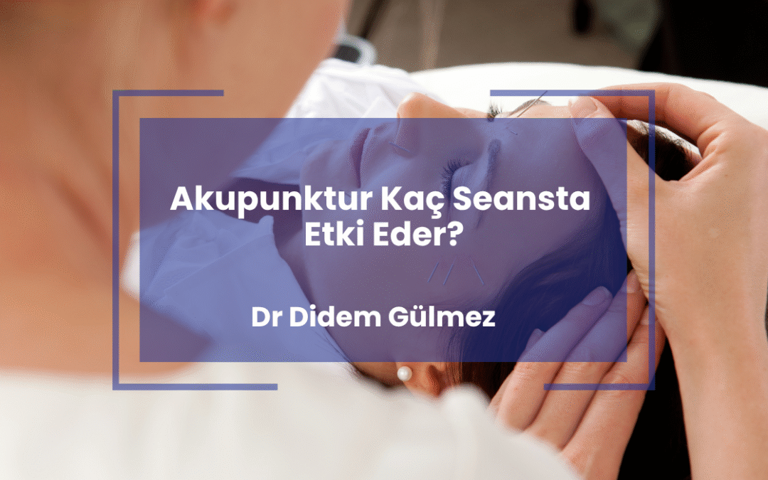 Akupunktur Kaç Seansta Etki Eder?