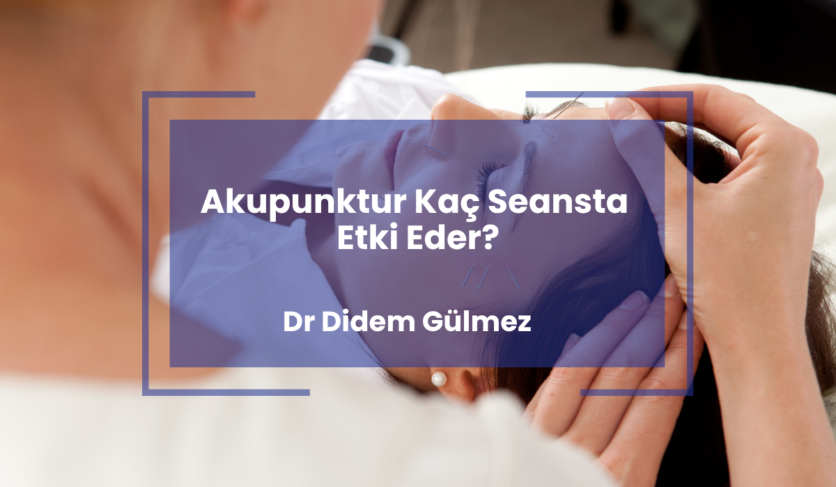 Akupunktur Kaç Seansta Etki Eder?