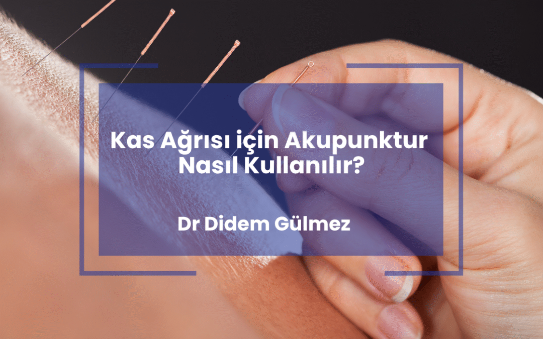 Kas Ağrısı için Akupunktur Nasıl Kullanılır?