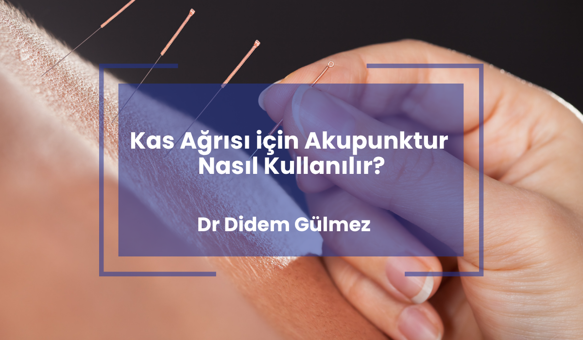 Kas Ağrısı için Akupunktur Nasıl Kullanılır?