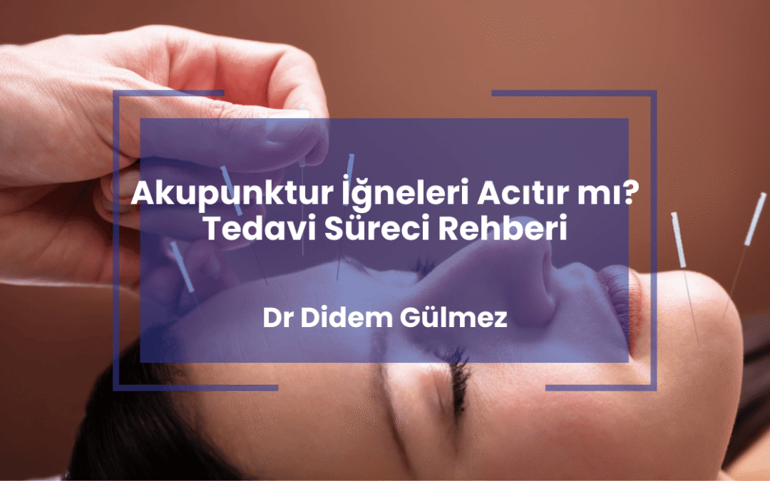 Akupunktur İğneleri Acıtır mı? Tedavi Süreci Rehberi