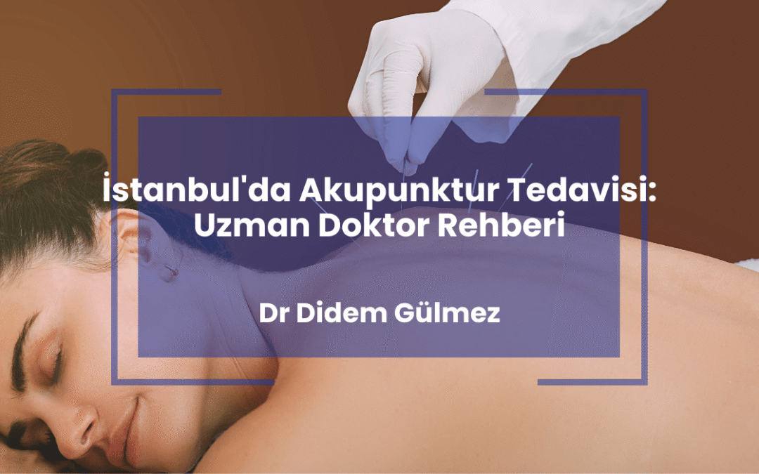 İstanbul’da Akupunktur Tedavisi: Uzman Doktor Rehberi