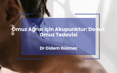 Omuz Ağrısı için Akupunktur: Donuk Omuz Tedavisi