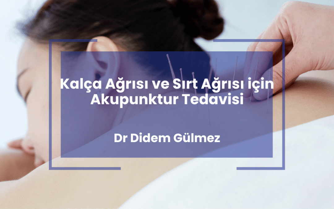 Kalça Ağrısı ve Sırt Ağrısı için Akupunktur Tedavisi